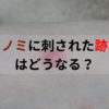 ノミに刺された跡はどうなる？実際の画像でご紹介