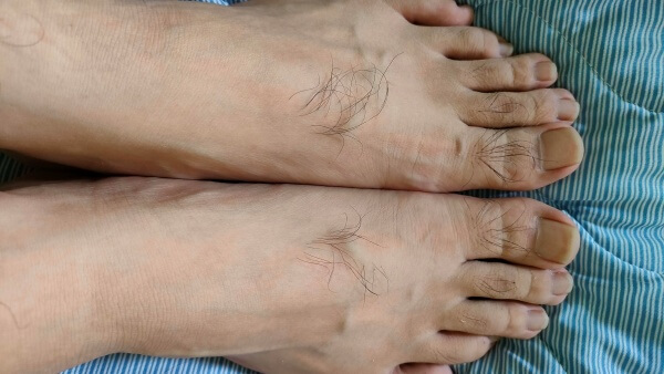 ケノンの脱毛器を使う前の足の甲の毛　足指のムダ毛