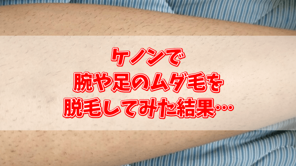 ケノン脱毛器の効果を検証！腕や足の剛毛を初めて脱毛してみた結果…