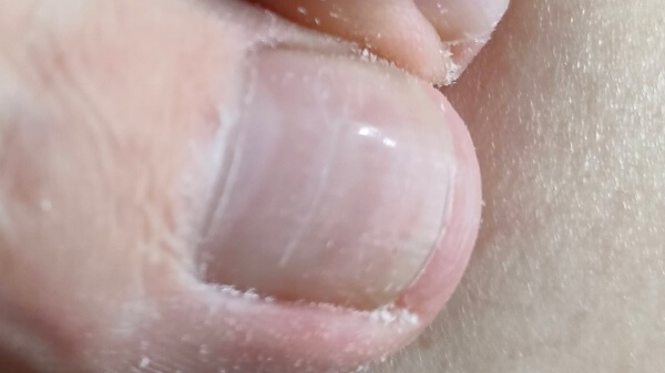 爪やすりで爪の表面を磨く時の注意点　傷　怪我