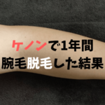 ケノン脱毛器の効果で腕毛が生えなくなる？実際に1年間使ってみた結果…